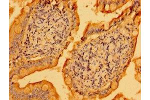 anti-Pleckstrin and Sec7 Domain Protein (PSD) (AA 247-489) antibody