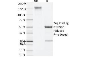 SDS-PAGE Analysis Purified IL-4 Rat Monoclonal Antibody (11B11). (IL-4 anticorps)