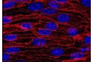 Immunofluorescence (IF) image for anti-Cadherin 5 (CDH5) (Extracellular Domain) antibody (FITC) (ABIN1105885)