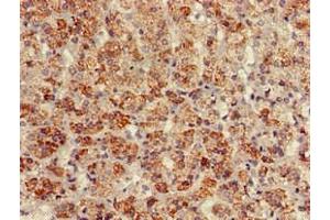 Immunohistochemistry of paraffin-embedded human adrenal gland tissue using ABIN7145218 at dilution of 1:100