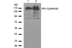 Image no. 2 for anti-Insulin Receptor Substrate 1 (IRS1) (pSer639) antibody (ABIN196981) (IRS1 anticorps  (pSer639))