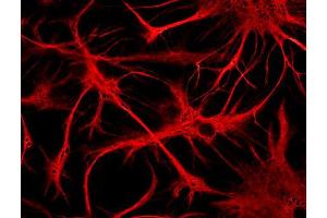 Indirect immunostaining of cultured rat astrocytes (dilution 1 : 500). (GFAP anticorps)