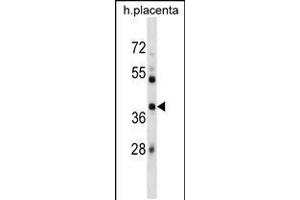 Western blot analysis in human placenta tissue lysates (35ug/lane). (SIAH1 anticorps  (AA 92-120))