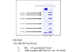 Gel Scan of Lipoproteins, Intermediate Density, Human Plasma  This information is representative of the product ART prepares, but is not lot specific.