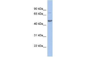 WB Suggested Anti-CBX8 Antibody Titration:  0. (CBX8 anticorps  (N-Term))