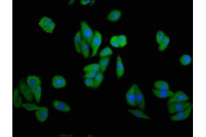 Immunofluorescence staining of HepG2 cells with ABIN7148935 at 1:133, counter-stained with DAPI.