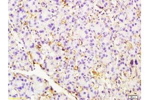 Formalin-fixed and paraffin embedded rat pancreas tissue labeled with Anti-CD105 Polyclonal Antibody , Unconjugated at 1:200 followed by conjugation to the secondary antibody, (SP-0023), and DAB staining