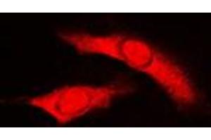 Immunofluorescent analysis of RAD23B staining in HuvEc cells. (RAD23B anticorps  (N-Term))