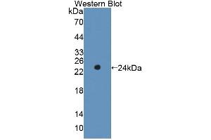 Western blot analysis of the recombinant protein. (RIPK1 anticorps  (AA 1-179))