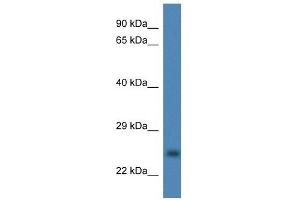 Western Blot showing CCS antibody used at a concentration of 1 ug/ml against Fetal Liver Lysate