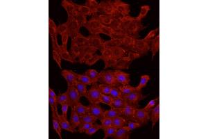 Immunofluorescence analysis of C2C12 cells using GLUT4 antibody (ABIN6134112, ABIN6147963, ABIN6147964 and ABIN6223551) at dilution of 1:100 (40x lens).