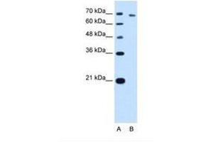 Image no. 2 for anti-threonyl-tRNA Synthetase (TARS) (AA 51-100) antibody (ABIN341310) (TARS anticorps  (AA 51-100))