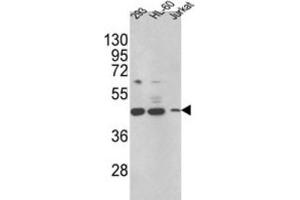 Western Blotting (WB) image for anti-Hydroxysteroid (17-Beta) Dehydrogenase 7 (HSD17B7) antibody (ABIN3002789) (HSD17B7 anticorps)
