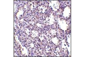 Immunohistochemistry of STIM2 in human spleen tissue with this product at 2. (Stim2 anticorps  (Center))