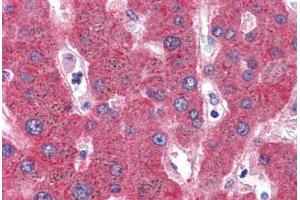 Human Liver (formalin-fixed, paraffin-embedded) stained with SERPINF2 antibody ABIN351490 at 3. (alpha 2 Antiplasmin anticorps  (AA 454-468))