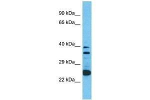 Western Blotting (WB) image for anti-Olfactory Receptor, Family 2, Subfamily A, Member 12 (OR2A12) (C-Term) antibody (ABIN2791718) (OR2A12 anticorps  (C-Term))