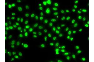 Immunofluorescence analysis of MCF7 cell using SETBP1 antibody. (SETBP1 anticorps)