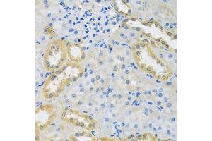 Immunohistochemistry of paraffin-embedded rat kidney using PMPCB antibody at dilution of 1:100 (x40 lens). (PMPCB anticorps)