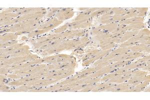 Detection of GPC3 in Human Cardiac Muscle Tissue using Monoclonal Antibody to Glypican 3 (GPC3)
