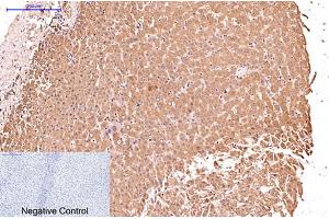 Immunohistochemical analysis of paraffin-embedded human liver tissue. (KRT17 anticorps)