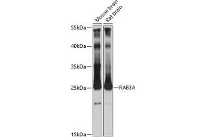 Western blot analysis of extracts of various cell lines, using RA antibody (ABIN7269809) at 1:3000 dilution.