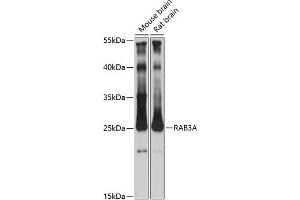 Western blot analysis of extracts of various cell lines, using RA antibody (ABIN7269809) at 1:3000 dilution. (RAB3A anticorps  (AA 100-200))
