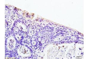 Formalin-fixed and paraffin embedded rat colitis tissue labeled with Anti-PAR-2 Polyclonal Antibody, Unconjugated  at 1:200 followed by conjugation to the secondary antibody and DAB staining