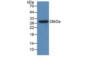 Detection of Recombinant CYP1A1, Human using Polyclonal Antibody to Cytochrome P450 1A1 (CYP1A1)