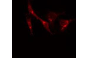 ABIN6274218 staining Hela cells by IF/ICC. (Calreticulin anticorps  (N-Term))