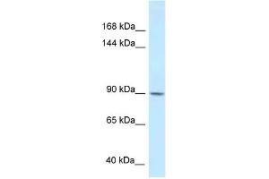 WB Suggested Anti-DACT1 Antibody Titration: 1. (DACT1 anticorps  (Middle Region))