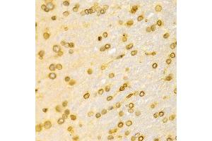 Immunohistochemistry of paraffin-embedded Rat brain using LMNB1 antibody at dilution of 1:100 (x400 lens).