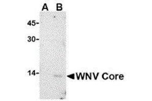 Western Blotting (WB) image for anti-2'-5' Oligoadenylate Synthetase 1B (OAS1B) (C-Term) antibody (ABIN2477148) (OAS1B anticorps  (C-Term))
