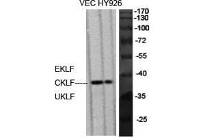 Western Blot (WB) analysis of specific cells using EKLF/CKLF/UKLF Polyclonal Antibody. (EKLF/CKLF/UKLF (C-Term) anticorps)