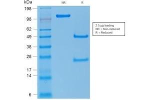 SDS-PAGE Analysis Purified p53 Rabbit Polyclonal Antibody. (p53 anticorps)