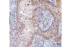 IHC analysis of CSNK2K2 using anti-CSNK2K2 antibody (ABIN7602871).