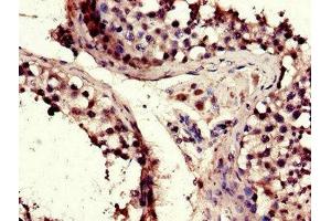 Immunohistochemistry of paraffin-embedded human testis tissue using ABIN7172803 at dilution of 1:100 (TACC3 anticorps  (AA 133-268))