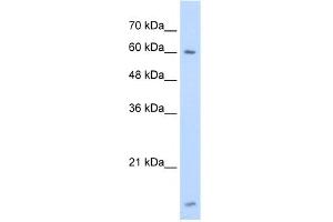WB Suggested Anti-HNRPL Antibody Titration:  1. (HNRNPL anticorps  (N-Term))