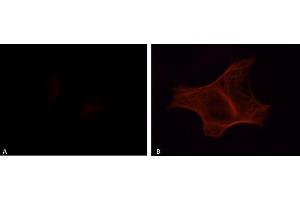 Immunofluorescence analysis of HeLa transfected cells stained with the anti-phospho-Tau (Tyr18) antibody, 1:200 dilution:  A: Tau,  B: Tau + Fyn