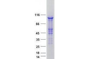 Validation with Western Blot