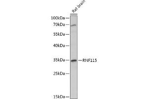 Western blot analysis of extracts of Rat brain, using RNF115 antibody (ABIN7270056) at 1:1000 dilution. (RNF115 anticorps  (AA 30-140))