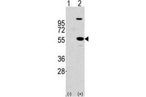 Image no. 2 for anti-Aldehyde Dehydrogenase 1 Family, Member A1 (ALDH1A1) (Center) antibody (ABIN356973) (ALDH1A1 anticorps  (Center))