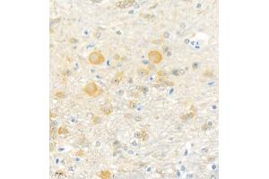 Immunohistochemistry analysis of paraffin embedded mouse cerebellum using Erc2 (ABIN7073808) at dilution of 1: 3000 (ERC2 anticorps)