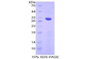SDS-PAGE (SDS) image for Numb Homolog (NUMB) (AA 377-642) protein (His tag) (ABIN2126183)
