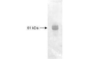 Both the antiserum and IgG fractions of anti-Carboxypeptidase Y are shown to detect under reducing conditions of SDS-PAGE the 61 KDa enzyme in cellular extracts.