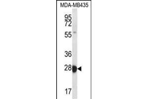 RAB27B Antibody (Center) (ABIN656670 and ABIN2845910) western blot analysis in MDA-M cell line lysates (35 μg/lane). (RAB27B anticorps  (AA 121-150))