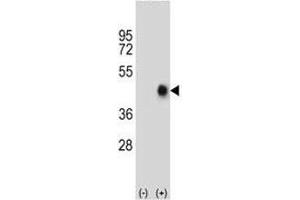 Western blot analysis of FAS antibody and 293 cell lysate (2 ug/lane) either nontransfected (Lane 1) or transiently transfected (2) with the human gene.