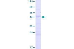 Image no. 1 for Death Effector Domain Containing 2 (DEDD2) (AA 1-185) protein (GST tag) (ABIN1351402)