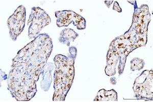 IHC analysis of Moesin/MSN using anti-Moesin/MSN antibody (ABIN7600379).