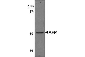 Western blot analysis of AFP in human liver tissue lysate with AFP Antibody (N-term) at 1 μg/ml. (alpha Fetoprotein anticorps  (N-Term))