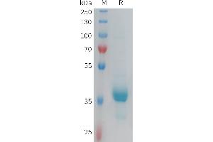Human CX3CR1 Protein, hFc Tag on SDS-PAGE under reducing condition.